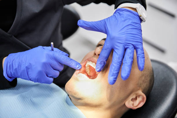 Best Emergency Tooth Extraction in Plover, WI
